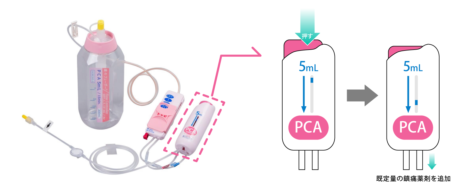 pca